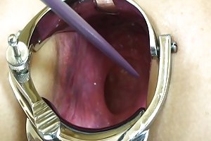 Frau extreme elmer - anal-klaffen!- amateur homemade porno download